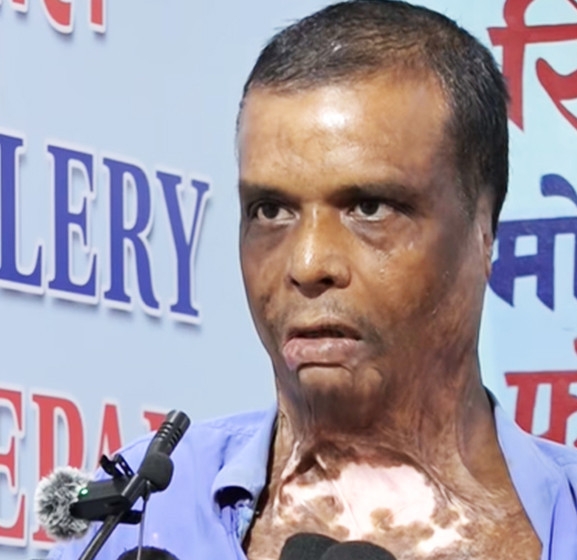 ‘बाँच्न चाहन्छु, तर आलमको त्रास छ’