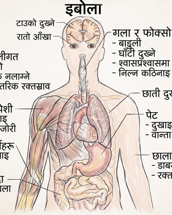 घातक इबोला भाइरस : उच्च सर्तकता
