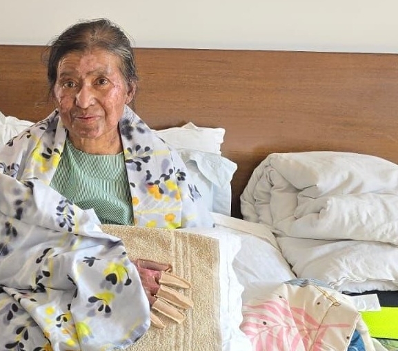 जेनजी आन्दोलनमा जलाइएकी प्राध्यापकको उपचारमा सकस