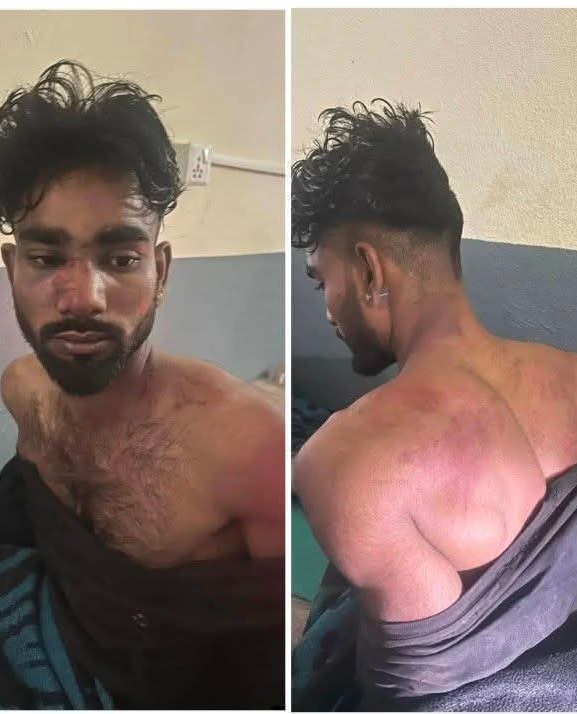 दलित बस्तीमा प्रवेश गरी कुटपिट गरेको आरोप