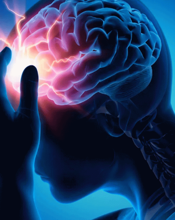 आज विश्व पक्षाघात दिवस मनाइँदै