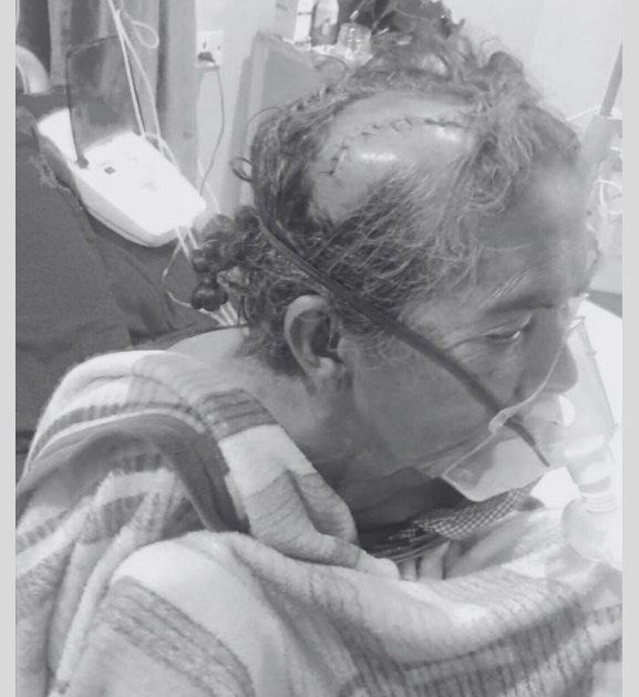 ठेकेदारको लापरबाहीले ६० वर्षीया वृद्धा घाइते, उपचार खर्च उपलब्ध नगराएको गुनासो 