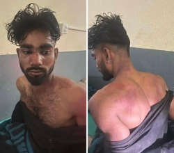 दलित बस्तीमा प्रवेश गरी कुटपिट गरेको आरोप