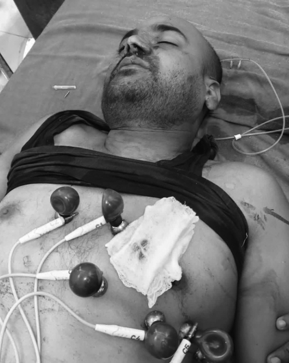 सर्लाहीमा सव-इन्जिनियरमाथि गोली प्रहार, उपचारका क्रममा मृत्यु