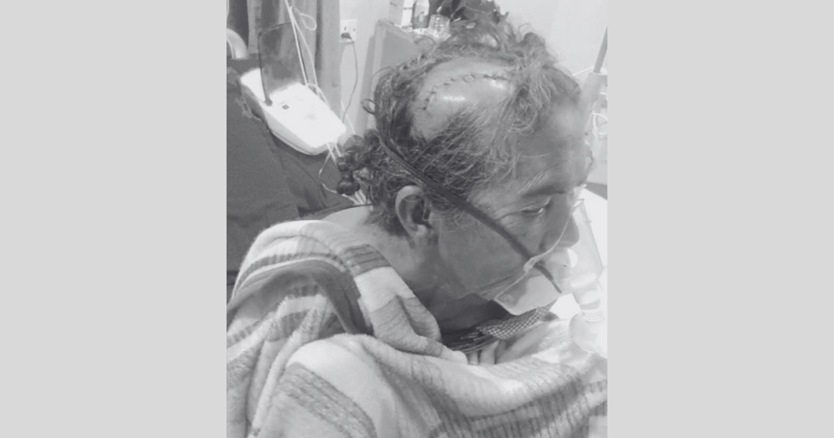 ठेकेदारको लापरबाहीले ६० वर्षीया वृद्धा घाइते, उपचार खर्च उपलब्ध नगराएको गुनासो 