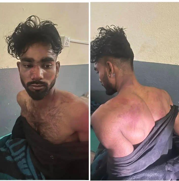 दलित बस्तीमा प्रवेश गरी कुटपिट गरेको आरोप